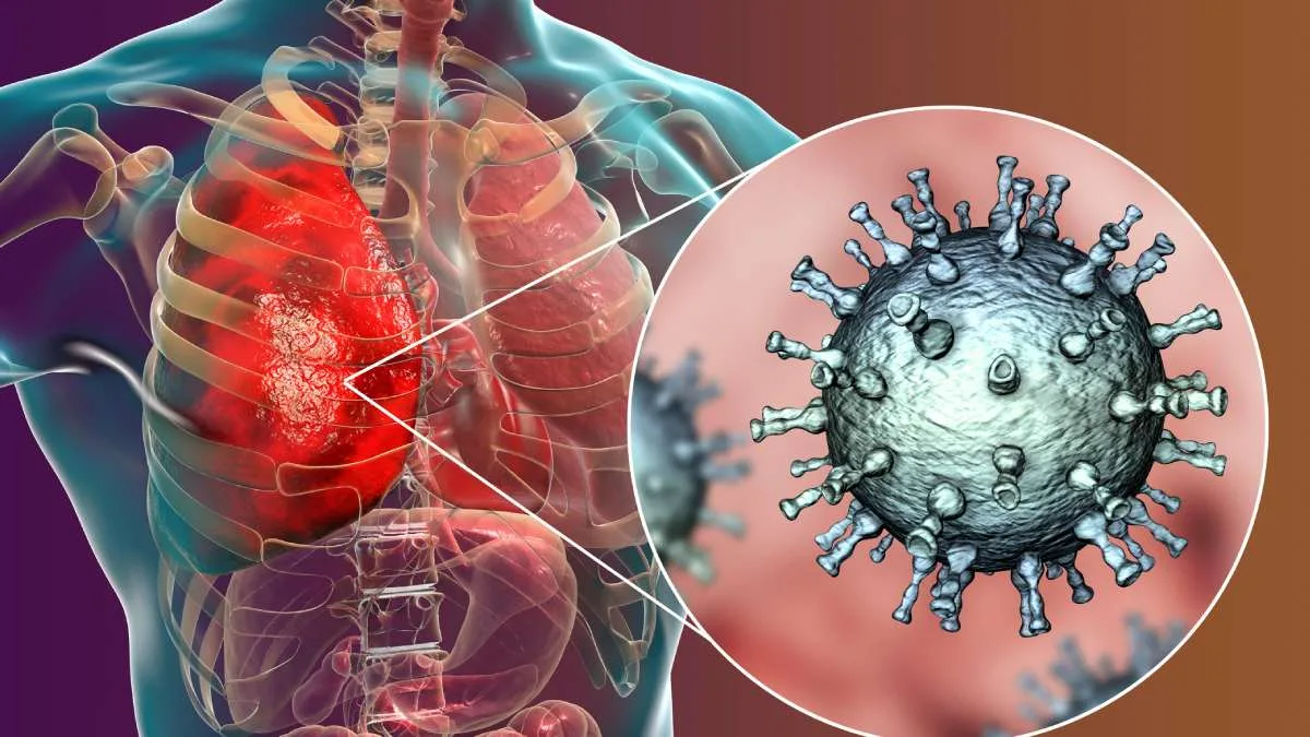 Metapneumovirus Humano 2